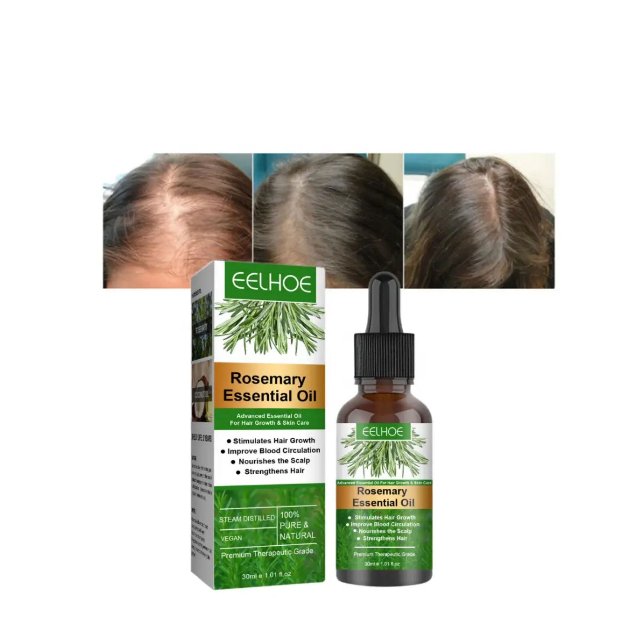 "Rosemary Hair Growth Essential Oil – Natural oil for promoting healthy hair growth, reducing hair loss, and nourishing scalp and strands."