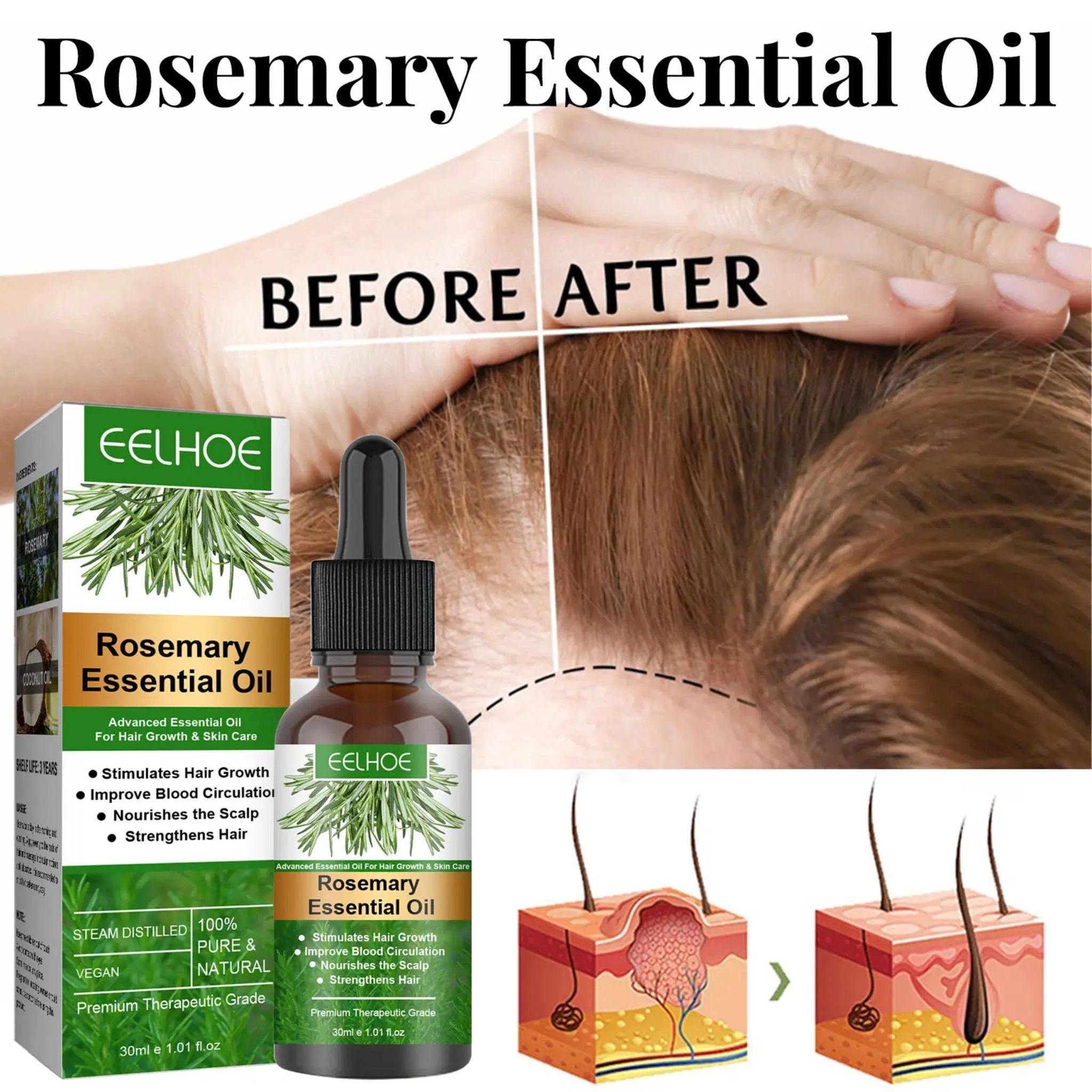 "Rosemary Hair Growth Essential Oil – Natural oil for promoting healthy hair growth, reducing hair loss, and nourishing scalp and strands."