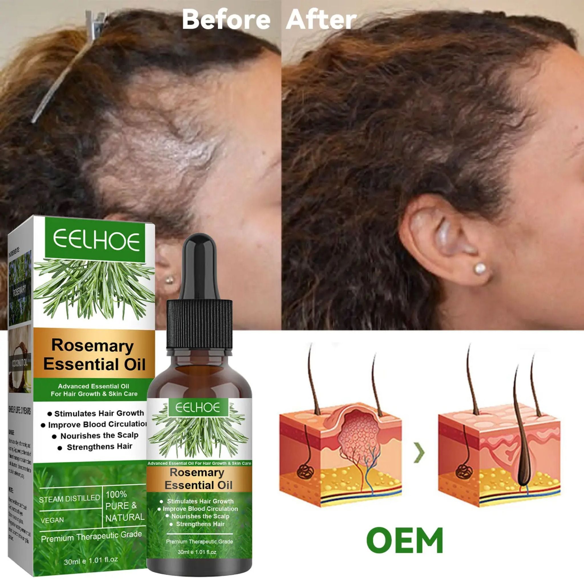 "Rosemary Hair Growth Essential Oil – Natural oil for promoting healthy hair growth, reducing hair loss, and nourishing scalp and strands."