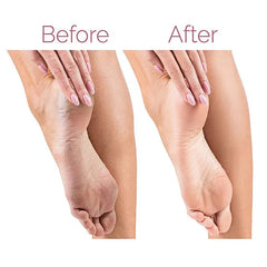 "Electric Pedicure Foot File and Callus Remover – Rechargeable device for smooth, soft feet, effectively removes hard skin and calluses."