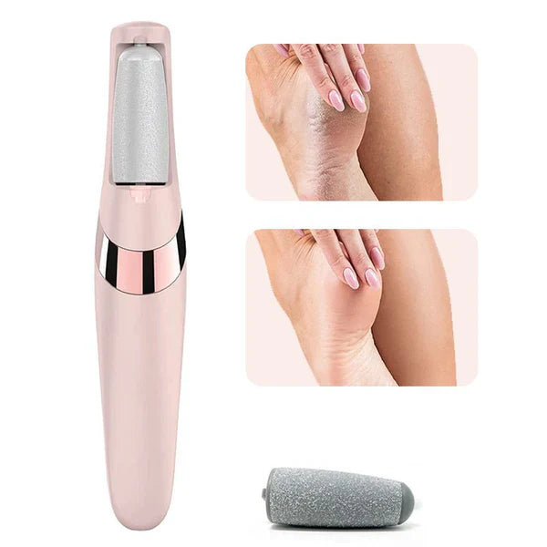 "Electric Pedicure Foot File and Callus Remover – Rechargeable device for smooth, soft feet, effectively removes hard skin and calluses."